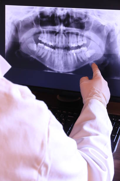 Best Emergency Dental Care for Abscessed Tooth in Bridgeport, TX