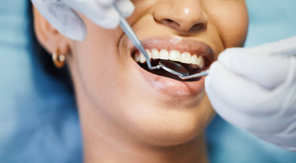 Best Emergency Dentist for Knocked-Out Tooth in Bridgeport, TX