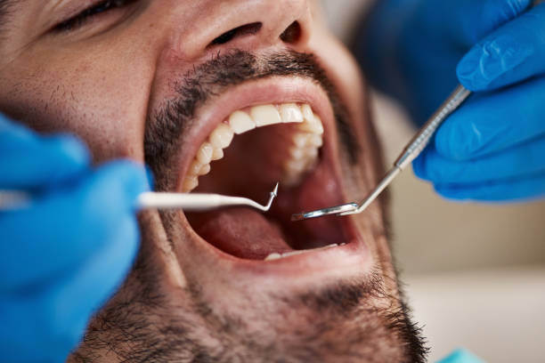 Best Broken or Cracked Tooth Emergency Dentist in Bridgeport, TX